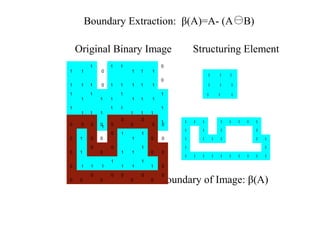 1 1
1
0
1 1
1 1 1
0
1 1 1 0 1 1 1 1 1
0
1
1
1
1 1
1
1 1 1
1
1
1 1 1
1 1
1 1 1
1
1
1 1 1
1 1
1 1 1
1
1 1 1
1 1 1
1 1 1
Original Binary Image Structuring Element
A B Boundary of Image: β(A)
Boundary Extraction: β(A)=A- (A B)
1 1 1 1 1 1 1 1
1 1 1 1
1 1 1 1 1 1
1 1
1 1 1 1 1 1 1 1 1 1
0 0 0 0 0
0
0
0
0 0
0 1 0 0
0 1
1
1
0 0
0 1
0
0
0
1 1
1
0 0
0 1 1 1
1
1 1
1
1 0
0 0
0
0
0 0
0
0
0
0
 