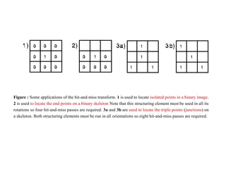 Figure : Some applications of the hit-and-miss transform. 1 is used to locate isolated points in a binary image.
2 is used to locate the end points on a binary skeleton Note that this structuring element must be used in all its
rotations so four hit-and-miss passes are required. 3a and 3b are used to locate the triple points (junctions) on
a skeleton. Both structuring elements must be run in all orientations so eight hit-and-miss passes are required.
 