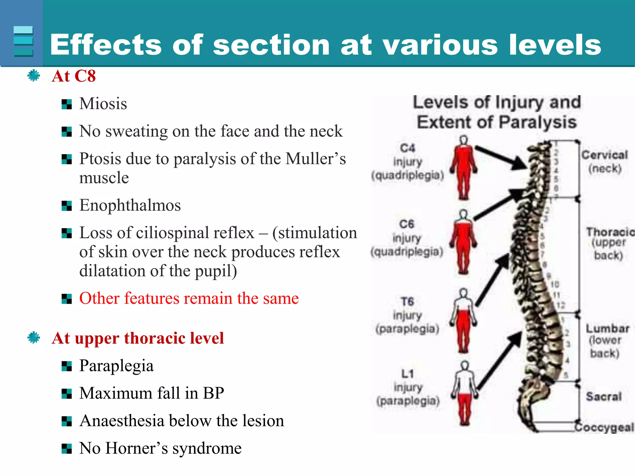 Effects of section at various levels
At C8
Miosis
No sweating on the face and the neck
Ptosis due to paralysis of the Muller’s
muscle
Enophthalmos
Loss of ciliospinal reflex – (stimulation
of skin over the neck produces reflex
dilatation of the pupil)
Other features remain the same
At upper thoracic level
Paraplegia
Maximum fall in BP
Anaesthesia below the lesion
No Horner’s syndrome
 