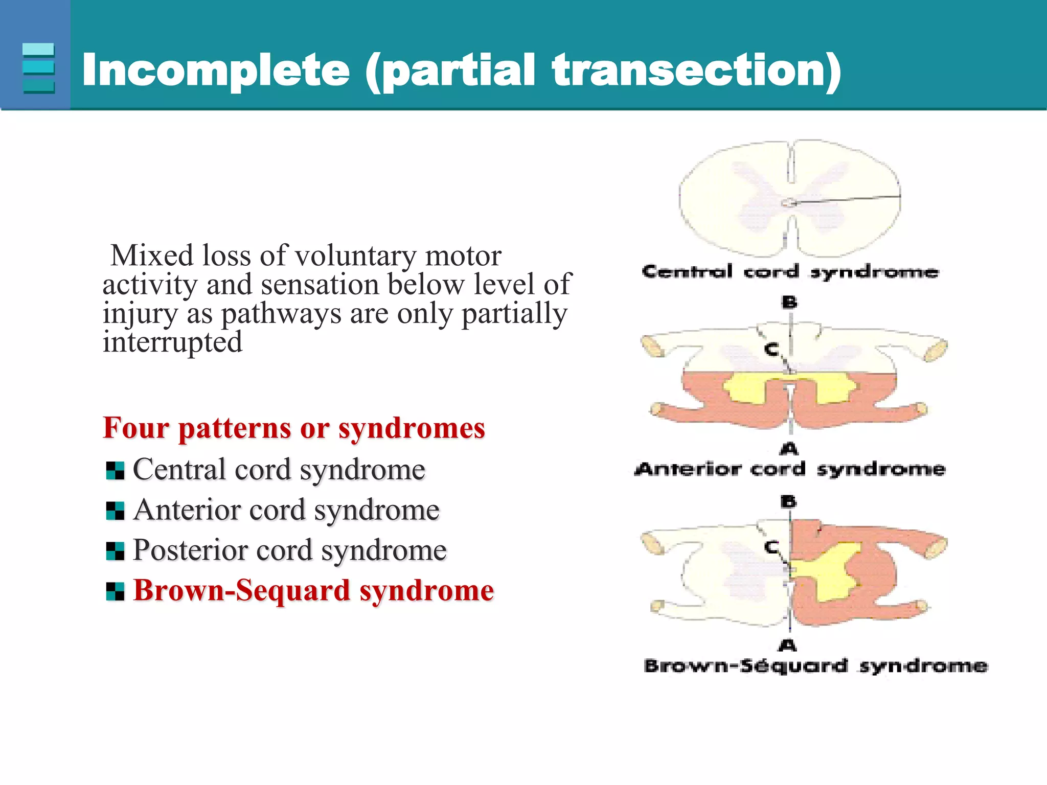 Incomplete (partial transection)
Mixed loss of voluntary motor
activity and sensation below level of
injury as pathways are only partially
interrupted
Four patterns or syndromes
Central cord syndrome
Anterior cord syndrome
Posterior cord syndrome
Brown-Sequard syndrome
 