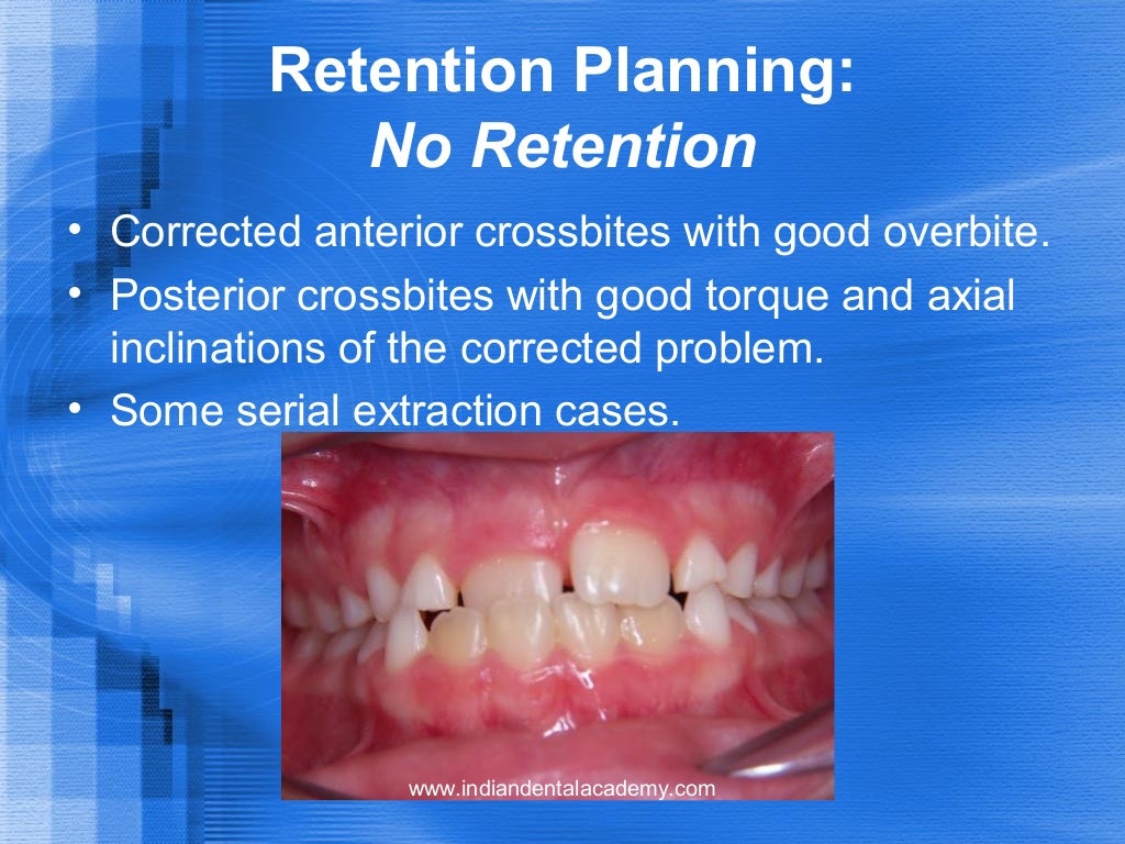 orthodontic finishing and retention