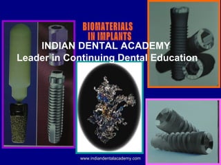 INDIAN DENTAL ACADEMY
Leader in Continuing Dental Education
www.indiandentalacademy.comwww.indiandentalacademy.com
 