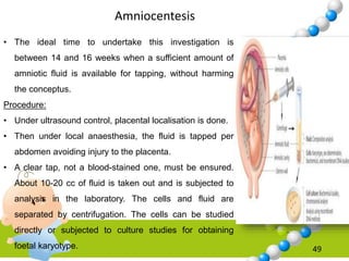49
Amniocentesis
• The ideal time to undertake this investigation is
between 14 and 16 weeks when a sufficient amount of
amniotic fluid is available for tapping, without harming
the conceptus.
Procedure:
• Under ultrasound control, placental localisation is done.
• Then under local anaesthesia, the fluid is tapped per
abdomen avoiding injury to the placenta.
• A clear tap, not a blood-stained one, must be ensured.
About 10-20 cc of fluid is taken out and is subjected to
analysis in the laboratory. The cells and fluid are
separated by centrifugation. The cells can be studied
directly or subjected to culture studies for obtaining
foetal karyotype.
 