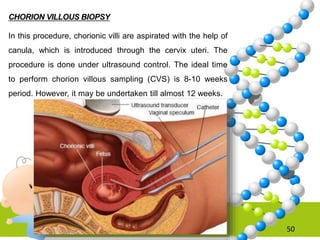50
CHORION VILLOUS BIOPSY
In this procedure, chorionic villi are aspirated with the help of
canula, which is introduced through the cervix uteri. The
procedure is done under ultrasound control. The ideal time
to perform chorion villous sampling (CVS) is 8-10 weeks
period. However, it may be undertaken till almost 12 weeks.
 