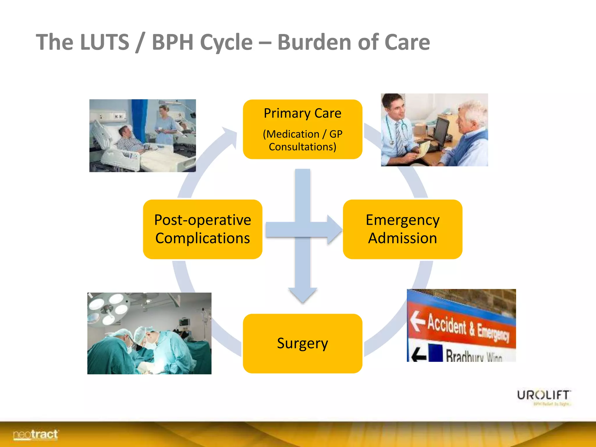 The LUTS / BPH Cycle – Burden of Care
NeoTract Confidential
Primary Care
(Medication / GP
Consultations)
Emergency
Admission
Surgery
Post-operative
Complications
 