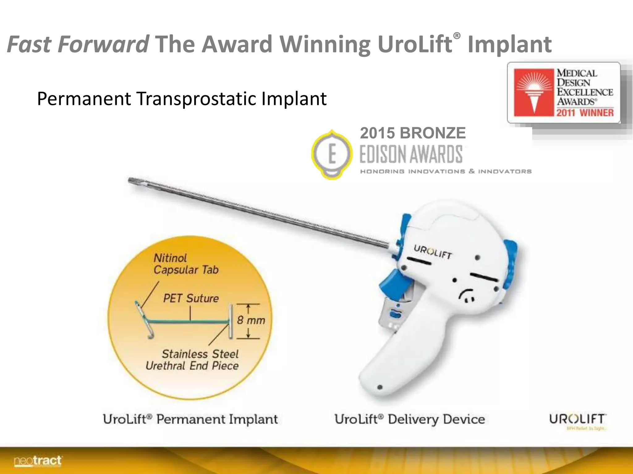 Fast Forward The Award Winning UroLift® Implant
Permanent Transprostatic Implant
2015 BRONZE
 