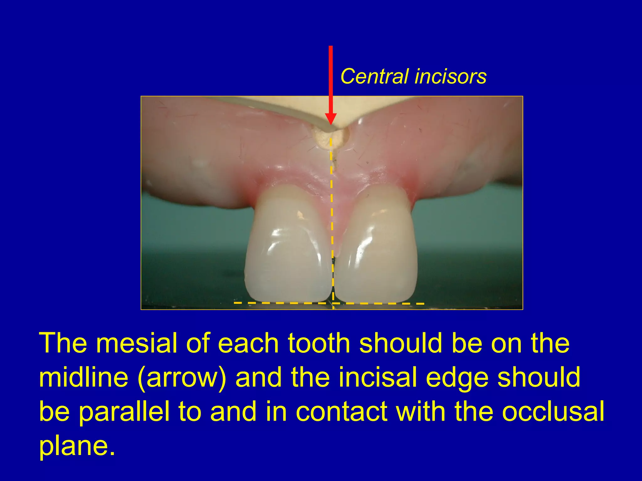 9. anterior teeth arrangement | PPT