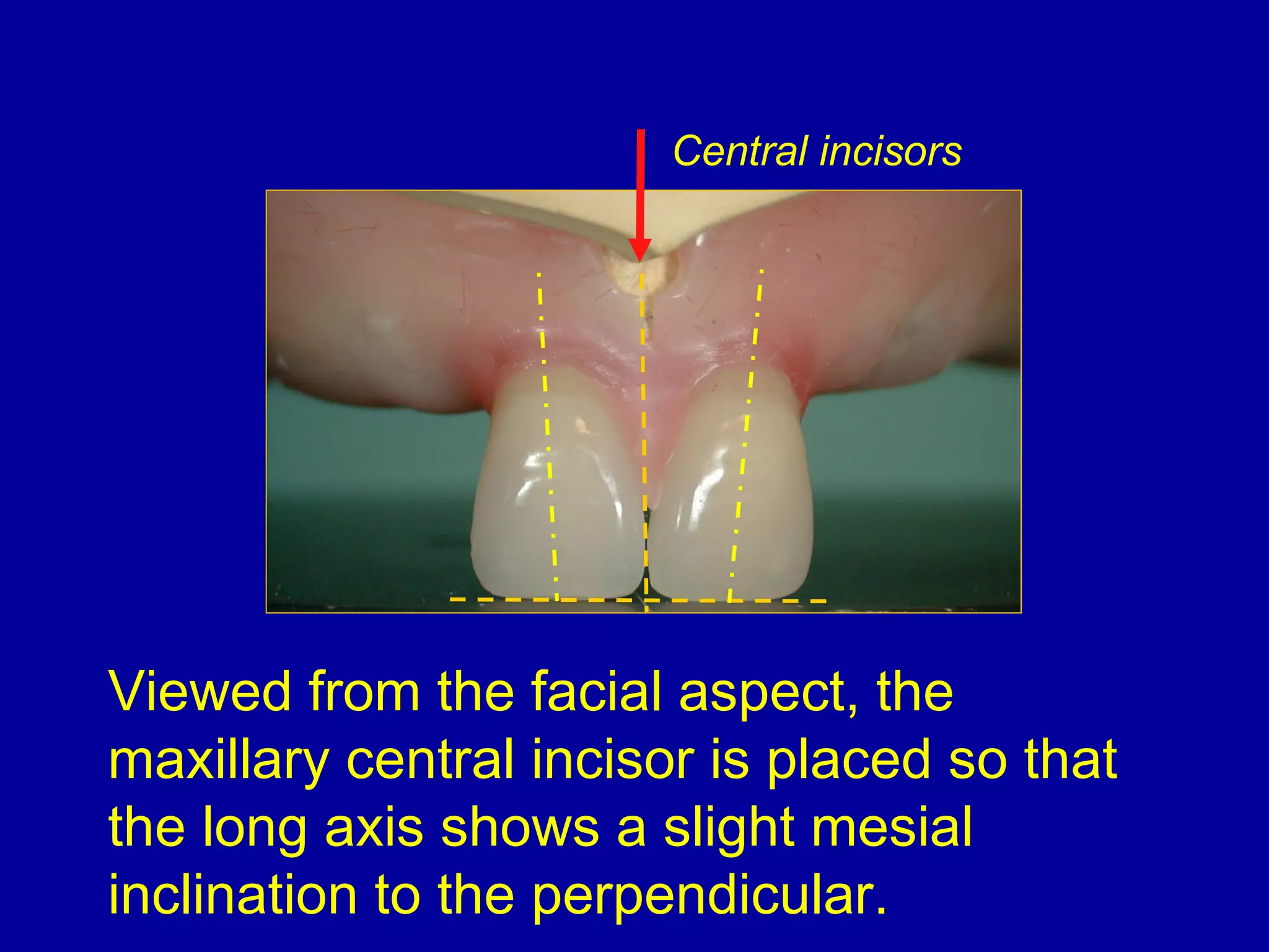 Central Incusors 9. anterior teeth arrangement | PPT