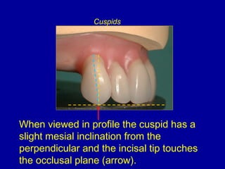 When viewed in profile the cuspid has a
slight mesial inclination from the
perpendicular and the incisal tip touches
the occlusal plane (arrow).
Cuspids
 