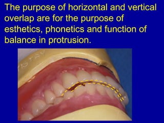 The purpose of horizontal and vertical
overlap are for the purpose of
esthetics, phonetics and function of
balance in protrusion.
 