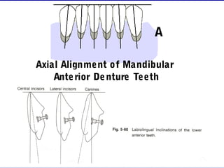 Axial Alignment of MandibularAxial Alignment of Mandibular
Anterior Denture TeethAnterior Denture Teeth
A. Facial View.A. Facial View.
B. Proximal View.B. Proximal View.
B
A
 