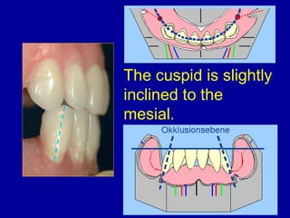 The cuspid is slightly
inclined to the
mesial.
 