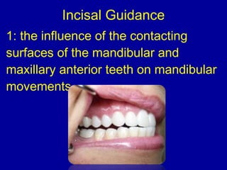 Incisal Guidance
1: the influence of the contacting
surfaces of the mandibular and
maxillary anterior teeth on mandibular
movements.
 