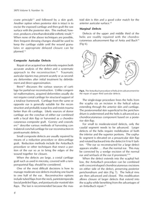 plastic surgery of the ear | PDF