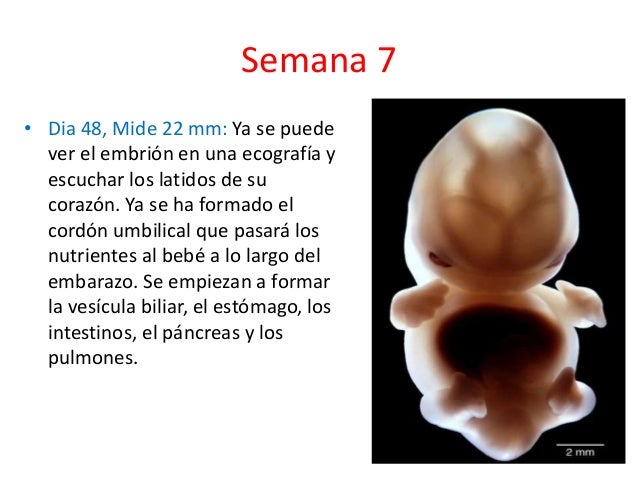 9 Organogenesis 4ta A 8va Semana
