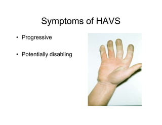 Hand Arm Vibration Syndrome