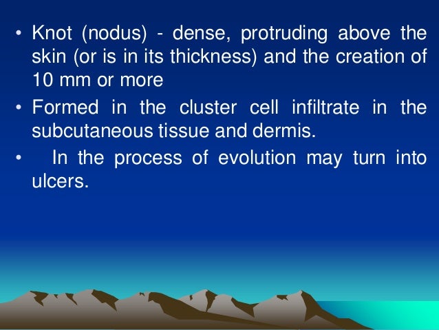 nodus definition nodus definition