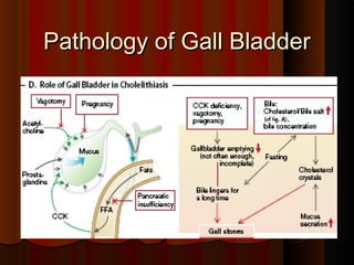 Pathology of Gall BladderPathology of Gall Bladder
 