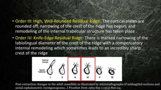 • Order III: High, Well-Rounded Residual Ridge: The cortical plates are
rounded off, narrowing of the crest of the ridge has begun, and
remodeling of the internal trabecular structure has taken place .
• Order IV: Knife-Edge Residual Ridge: There is marked narrowing of the
labiolingual diameter of the crest of the ridge with a compensatory
internal remodeling which sometimes leads to an incredibly sharp
crest of the ridge
Post-extraction changes in the adult mandible as illustrated by microradiographs of midsagittal sections and
serial cephalometric roentgenograms. J Prosthet Dent.1963 Sep 1;13(5):810-24.
 