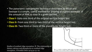 • The panoramic radiographic technique described by Wical and
Swoope is a simple, useful method for arriving at a gross estimate of
the amount of RRR to date in a given patient.
• Class I- Upto one third of the original vertical height lost.
• Class II- From one third to two third of the vertical height lost.
• Class III- Two third or more of the mandibular height lost.
Studies of residual ridge resorption. II. The relationship of
dietary calcium and phosphorus to residual ridge
resorption. J Prosthet Dent 1974;32:13–22.
 