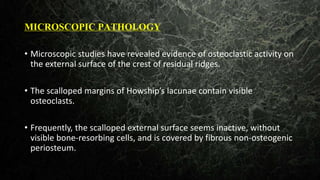 MICROSCOPIC PATHOLOGY
• Microscopic studies have revealed evidence of osteoclastic activity on
the external surface of the crest of residual ridges.
• The scalloped margins of Howship’s lacunae contain visible
osteoclasts.
• Frequently, the scalloped external surface seems inactive, without
visible bone-resorbing cells, and is covered by fibrous non-osteogenic
periosteum.
 
