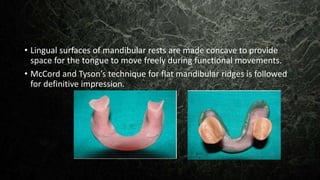 • Lingual surfaces of mandibular rests are made concave to provide
space for the tongue to move freely during functional movements.
• McCord and Tyson’s technique for flat mandibular ridges is followed
for definitive impression.
 