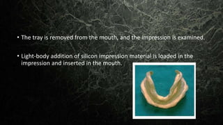 • The tray is removed from the mouth, and the impression is examined.
• Light-body addition of silicon impression material is loaded in the
impression and inserted in the mouth.
 