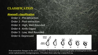 CLASSIFICATION
Atwood’s classification
Order 1 : Pre-extraction
Order 2 : Post-extraction
Order 3 : High, Well Rounded
Order 4 : Knife Edged
Order 5 : Low, Well Rounded
Order 6: Depressed
Post-extraction changes in the adult mandible as illustrated by microradiographs of midsagittal sections and
serial cephalometric roentgenograms. J Prosthet Dent.1963 Sep 1;13(5):810-24.
 