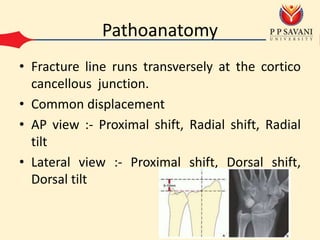 Pathoanatomy
• Fracture line runs transversely at the cortico
cancellous junction.
• Common displacement
• AP view :- Proximal shift, Radial shift, Radial
tilt
• Lateral view :- Proximal shift, Dorsal shift,
Dorsal tilt
 