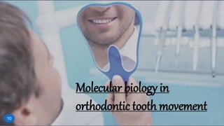 Molecular biology in
orthodontic tooth movement
10
 
