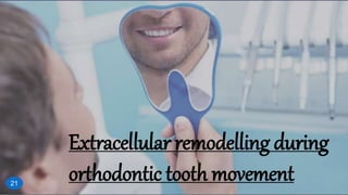 Extracellular remodelling during
orthodontic tooth movement21
 
