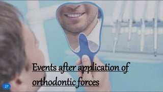 Events after application of
orthodontic forces27
 