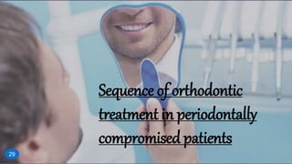 Sequence of orthodontic
treatment in periodontally
compromised patients
29
 