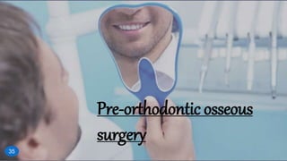 Pre-orthodontic osseous
surgery
35
 