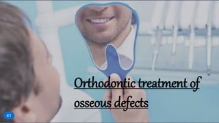 Orthodontic treatment of
osseous defects
41
 