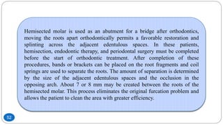 Hemisected molar is used as an abutment for a bridge after orthodontics,
moving the roots apart orthodontically permits a favorable restoration and
splinting across the adjacent edentulous spaces. In these patients,
hemisection, endodontic therapy, and periodontal surgery must be completed
before the start of orthodontic treatment. After completion of these
procedures, bands or brackets can be placed on the root fragments and coil
springs are used to separate the roots. The amount of separation is determined
by the size of the adjacent edentulous spaces and the occlusion in the
opposing arch. About 7 or 8 mm may be created between the roots of the
hemisected molar. This process eliminates the original furcation problem and
allows the patient to clean the area with greater efficiency.
52
 