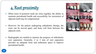 4. Root proximity
 When roots of posterior teeth are close together, the ability to
maintain periodontal health and accessibility for restoration of
adjacent teeth may be compromised.
 However, for the patient undergoing orthodontic therapy, the
roots can be moved apart, and bone will form between the
adjacent roots.
 Radiographs are needed to monitor the progress of orthodontic
root separation. Generally, 2 to 3 mm of root separation
provides an adequate bone and embrasure space to improve
periodontal health.
56
 