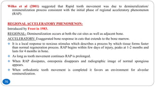 Wilko et al (2001) suggested that Rapid tooth movement was due to demineralization/
remineralization process consistent with the initial phase of regional acceleratory phenomenon
(RAP).
REGIONALACCELERATORY PHENOMENON-
Introduced by Frost in 1983.
REGIONAL- Demineralization occurs at both the cut sites as well as adjacent bone.
ACCELERATORY- Exaggerated bone response in cuts that extends to the bone marrow.
 It is a local response to noxious stimulus which describes a process by which tissue forms faster
than normal regeneration process. RAP begins within few days of injury, peaks at 1-2 months and
lasts for 4 months in bone.
 As long as tooth movement continues RAP is prolonged.
 When RAP dissipates, osteopenia disappears and radiographic image of normal spongiosa
appears.
 When orthodontic tooth movement is completed it favors an environment for alveolar
remineralization.
76
 