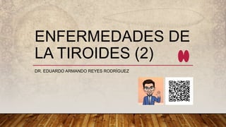 ENFERMEDADES DE
LA TIROIDES (2)
DR. EDUARDO ARMANDO REYES RODRÍGUEZ
 