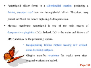 Page 132
 Pemphigoid blister forms in a subepithelial location, producing a
thicker, stronger roof than the intraepithelial blister. Therefore, may
persist for 24-48 hrs before rupturing & desquamation.
 Mucous membrane pemphigoid is one of the main causes of
desquamative gingivitis (DG). Indeed, DG is the main oral feature of
MMP and may be the presenting feature.
• Desquamating lesions rupture leaving raw eroded
areas, bleeding surfaces.
• Gingiva manifest erythema for weeks even after
original erosions are healed.
 