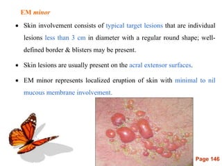 Page 146
EM minor
 Skin involvement consists of typical target lesions that are individual
lesions less than 3 cm in diameter with a regular round shape; well-
defined border & blisters may be present.
 Skin lesions are usually present on the acral extensor surfaces.
 EM minor represents localized eruption of skin with minimal to nil
mucous membrane involvement.
 