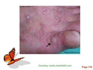 Page 176
Courtesy: toufiq.medinfo24.com
 
