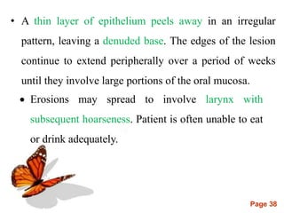 Page 38
• A thin layer of epithelium peels away in an irregular
pattern, leaving a denuded base. The edges of the lesion
continue to extend peripherally over a period of weeks
until they involve large portions of the oral mucosa.
 Erosions may spread to involve larynx with
subsequent hoarseness. Patient is often unable to eat
or drink adequately.
 