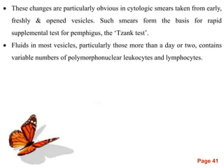 Page 41
 These changes are particularly obvious in cytologic smears taken from early,
freshly & opened vesicles. Such smears form the basis for rapid
supplemental test for pemphigus, the ‘Tzank test’.
 Fluids in most vesicles, particularly those more than a day or two, contains
variable numbers of polymorphonuclear leukocytes and lymphocytes.
 
