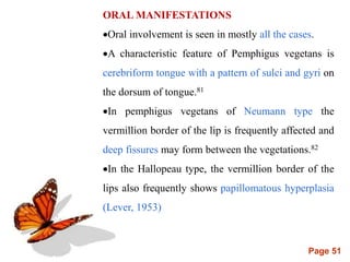 Page 51
ORAL MANIFESTATIONS
Oral involvement is seen in mostly all the cases.
A characteristic feature of Pemphigus vegetans is
cerebriform tongue with a pattern of sulci and gyri on
the dorsum of tongue.81
In pemphigus vegetans of Neumann type the
vermillion border of the lip is frequently affected and
deep fissures may form between the vegetations.82
In the Hallopeau type, the vermillion border of the
lips also frequently shows papillomatous hyperplasia
(Lever, 1953)
 