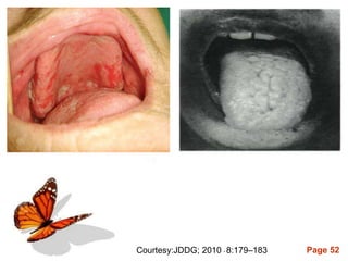 Page 52Courtesy:JDDG; 2010 • 8:179–183
 