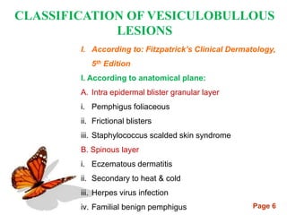 Page 6
CLASSIFICATION OF VESICULOBULLOUS
LESIONS
I. According to: Fitzpatrick’s Clinical Dermatology,
5th Edition
I. According to anatomical plane:
A. Intra epidermal blister granular layer
i. Pemphigus foliaceous
ii. Frictional blisters
iii. Staphylococcus scalded skin syndrome
B. Spinous layer
i. Eczematous dermatitis
ii. Secondary to heat & cold
iii. Herpes virus infection
iv. Familial benign pemphigus
 