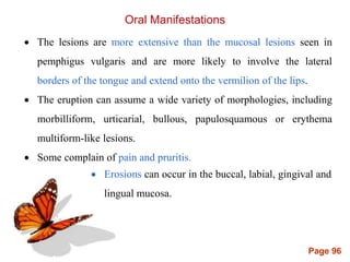 Page 96
Oral Manifestations
 The lesions are more extensive than the mucosal lesions seen in
pemphigus vulgaris and are more likely to involve the lateral
borders of the tongue and extend onto the vermilion of the lips.
 The eruption can assume a wide variety of morphologies, including
morbilliform, urticarial, bullous, papulosquamous or erythema
multiform-like lesions.
 Some complain of pain and pruritis.
 Erosions can occur in the buccal, labial, gingival and
lingual mucosa.
 