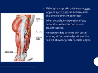 • Although a large skin paddle up to 35cm
long and 25cm wide can be harvested
on a single dominant perforator
• When possible, incorporation of two
perforators within the flap ensures
greater success.
• An eccentric flap with the skin vessel
entering at the proximal portion of the
flap will allow for greater pedicle length.
 