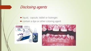 Disclosing agents
 liquid, capsule, tablet or lozenges
 contain a dye or other coloring agent
 